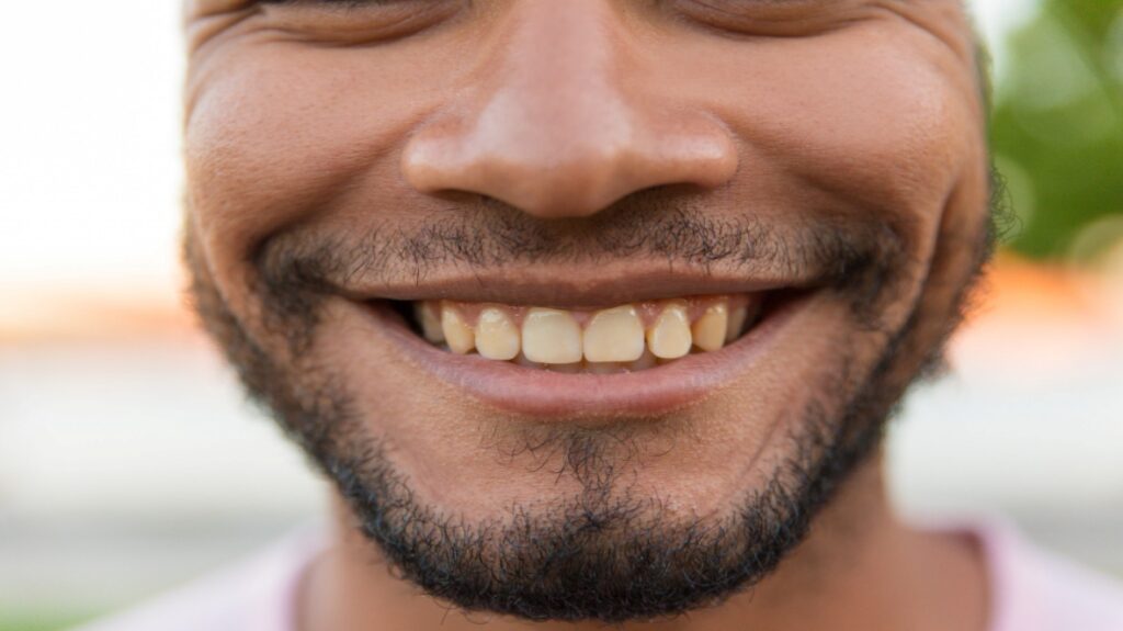 Escurecimento dos Dentes: Causas e Como Recuperar um Sorriso Brilhante