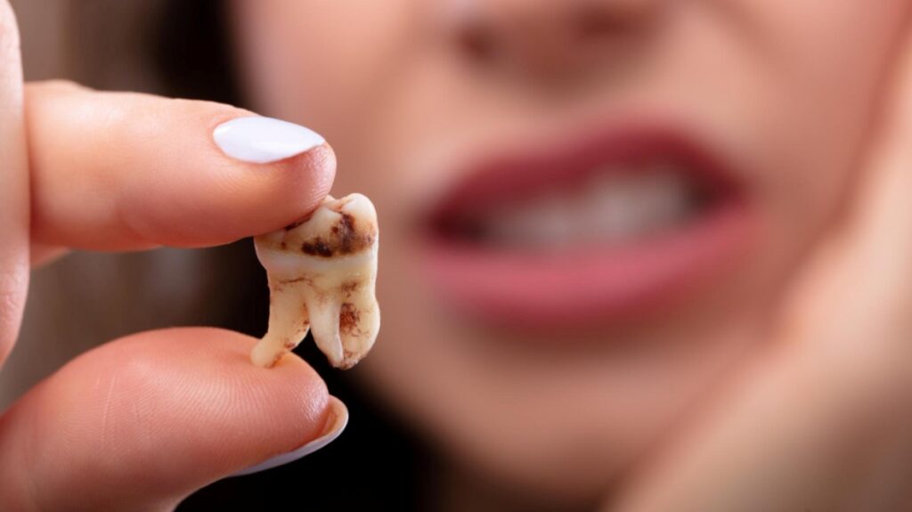 Como Prevenir Cáries: Dicas Essenciais para um Sorriso Saudável
